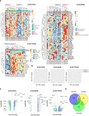 CHI3L1 on fibrinolytic system imbalance in chronic rhinosinusitis with nasal polyp